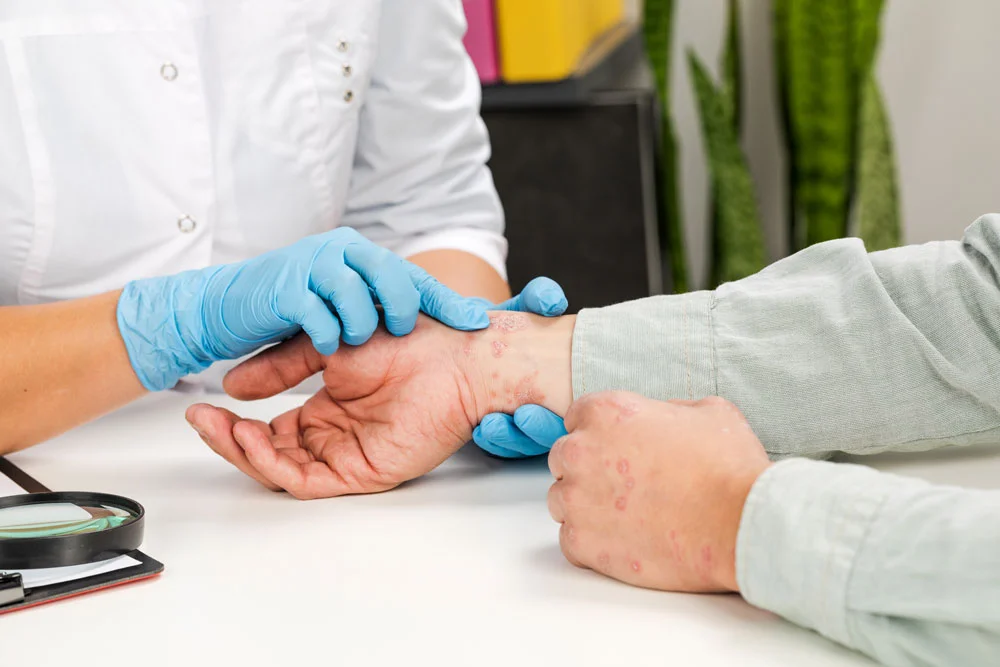Examination and diagnosis of skin diseases-allergies, psoriasis